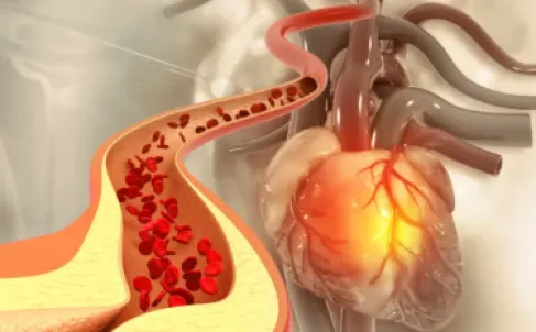 A Silent Marker Around the Eyes May Reveal the Risk of a Heart Attack