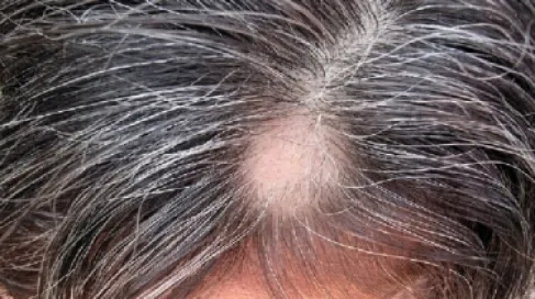 (الورد الدمشقي) قد يحمل سر التخلص من الشيب