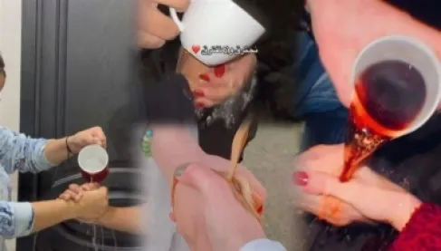 تريند «تحدي الشاي» الصادم يثير تحذيرات طبية واجتماعية من مخاطر الحروق على تيك توك