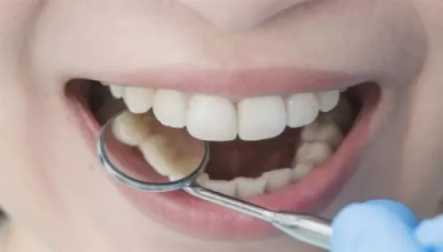 دراسة يابانية صادمة.. عدد أسنانك قد يتنبأ بموعد رحيلك