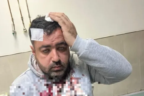 الاعتداء على الصحفي التميمي بالهراوات أمام منزله - فيديو