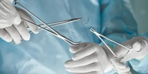 لأول مرة في تاريخ الطب البشري.. جراحة قلب دون شق الصدر