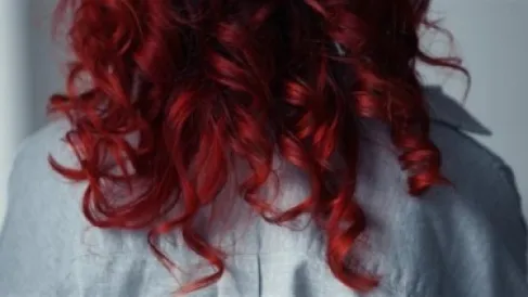 أصحاب الشعر الأحمر يشعرون بالألم بطريقة مختلفة.. العلم يكشف السر