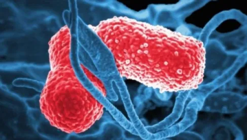 ظاهرة طبية غريبة.. متلازمة تُدخل البشر في حالة سُكر دون كحول