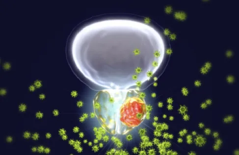رابط مقلق بين تلوث الهواء وزيادة خطر الإصابة بسرطان البروستات