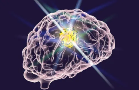 دواء فموي واعد ضد أورام دماغية عدوانية