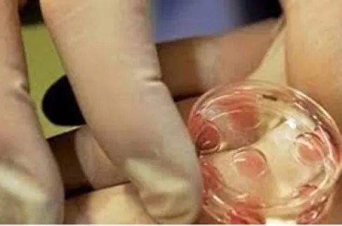 ما الذي يدفع شابات من جيل زد إلى تجميد بويضاتهن؟