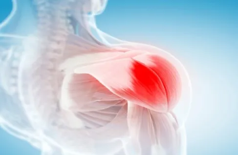 اكتشاف سبب آلام عضلية غامضة مرتبطة بدواء لخفض الكوليسترول