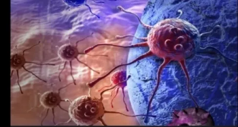 عامل خفي يؤثر على تطور السرطان