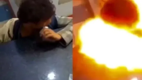 فيديو: مراهق يقضم بطارية هاتف فتنفجر داخل فمه