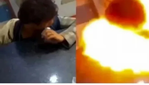 مراهق هندي «يعضّ بطارية» فتنفجر داخل فمه وتحرق وجهه