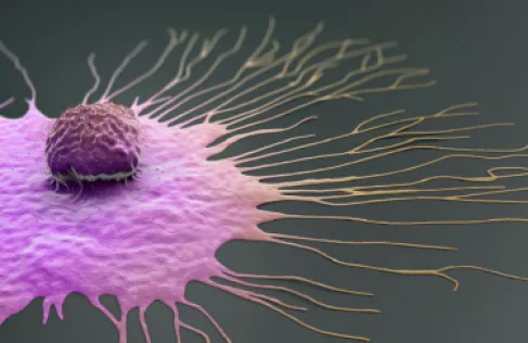 طبيب: السمنة قد تكون سببا لإصابة النساء بسرطانات خطيرة