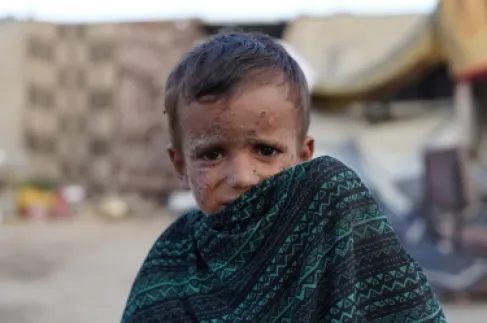 Meningitis besieges children in Gaza