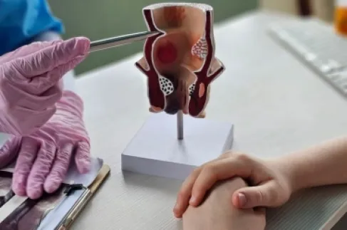 البواسير.. متى يصبح التدخل الجراحي ضرورة؟