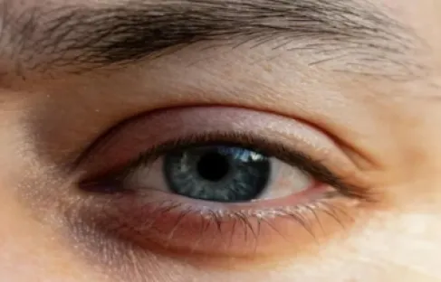 كيف كشف حذاء طفل (العمى الصامت) لوالده؟