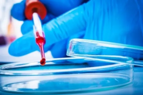 اختبار دم واحد يكشف عشرات السرطانات مبكرا