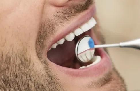 اكتشاف سبب غير متوقع لتدهور صحة الفم والأسنان