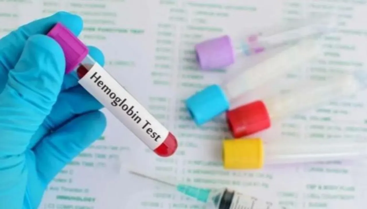 منتصف رمضان.. 5 تحاليل طبية يُنصح بإجراؤها لمراقبة الصحة 