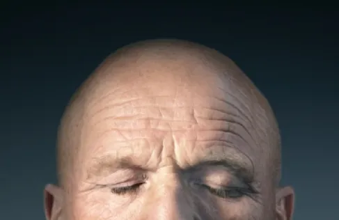 Revolutionary Innovation in Baldness Treatment.. Full-Function Hair Follicle Cultivation in the Lab for the First Time