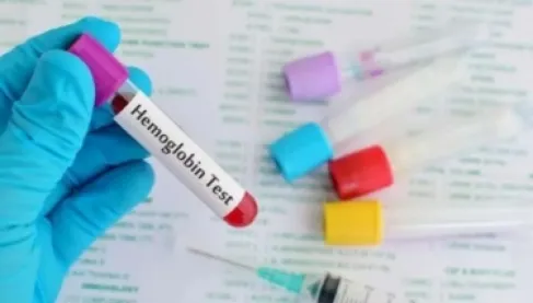 منتصف رمضان.. 5 تحاليل طبية يُنصح بإجراؤها لمراقبة الصحة