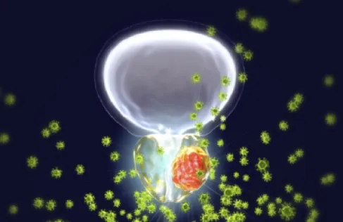 دكتور يحذر: العلاقة الحميمة لا تكفي للوقاية من سرطان البروستاتا