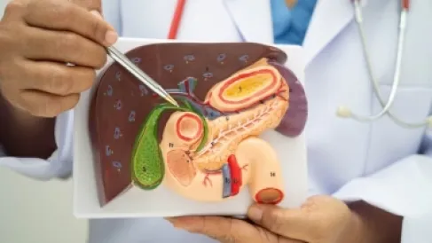 مرضى المرارة في رمضان.. اختيار الطعام سر الراحة