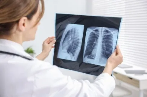 لماذا تتأثر النساء بأمراض الرئة أكثر من الرجال؟