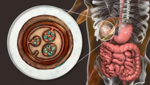 دراسة جزائرية: داء الأكياس المائية يهدد الأطفال في المناطق الريفية