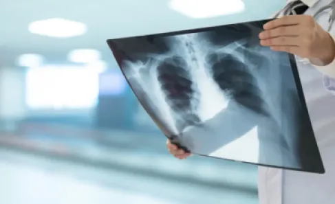 تحذير لمتعافي 