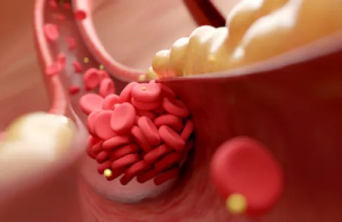 دواء فموي جديد يحقق انخفاضا كبيرا في الكوليسترول الضار