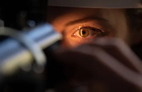 سبب خفي لإعتام عدسة العين