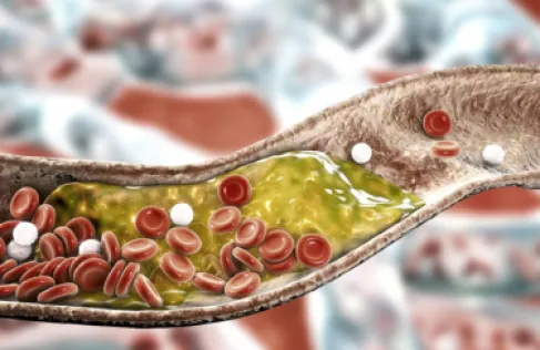 سرّ بسيط لصحة القلب.. أطعمة تخفض الكوليسترول خلال أسابيع