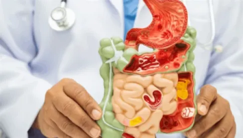 كيف يعيد النظام الغذائي برمجة الميكروبيوم لمنع نمو الخلايا السرطانية؟