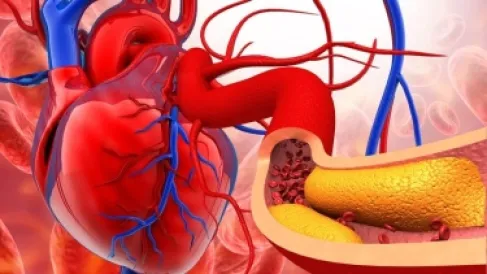 تقنية جديدة لفحص شرايين القلب دون تدخل معقد