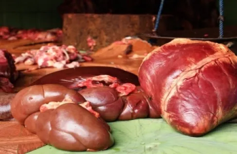 أطعمة مفيدة لرفع مستوى الهيموغلوبين ونقص الحديد