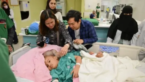 عملية معقدة تستمر 24 ساعة.. بدء فصل التوأم كليا وموريس آن في الرياض