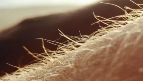 بصيلات الشعر «رادارات» مناعية ذكية تعزز دفاعات الجلد