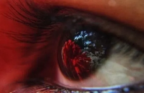 تقنية جديدة قد تنقذ الملايين من العمى