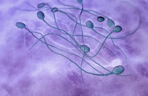 بديل للواقي الذكري.. طريقة ثورية توقف إنتاج الحيوانات المنوية لمنع الحمل
