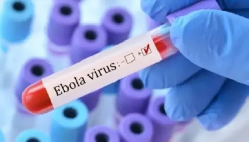 أمريكا تخصص 50 مليون دولار لتطوير علاجات لسلالة «بونديبوغيو» من إيبولا