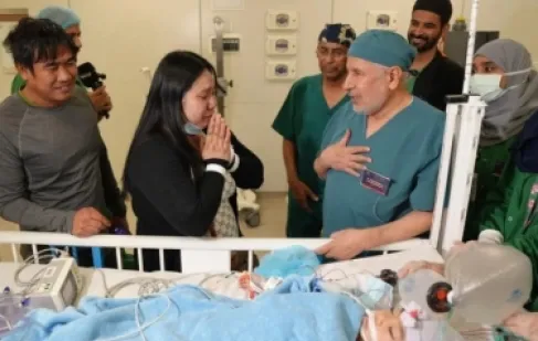 نجاح عملية فصل التوأم الفلبيني (أوليفيا وجيانا) في السعودية