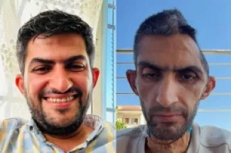 الصحفي الفلسطيني مجاهد بني مفلح قبل وبعد خروجه من سجون الاحتلال الإسرائيلي