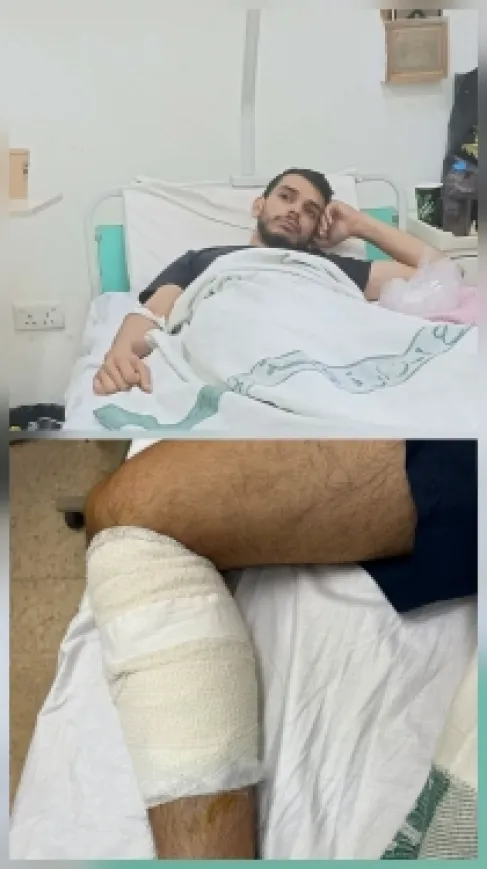 الاردن .. كلب ضال يهاجم سائق توصيل في إربد وينقله إلى المستشفى