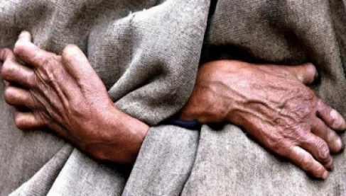 مرض الجذام يعود في فلوريدا.. تحذيرات من حيوان قد ينقل العدوى للبشر