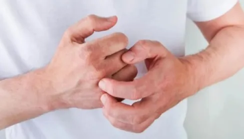 لماذا يصاب بعض الأطفال بالأكزيما أكثر من غيرهم؟ لغز خفي في نزلات البرد