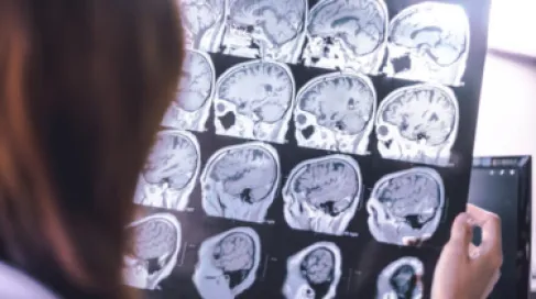 8 طرق لتقليل خطر الإصابة بأمراض الخرف.. تعرَّف عليها