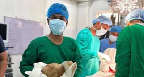 أطباء في سريلانكا يستخرجون من مثانة رجل حصاة بحجم بيضة نعامة