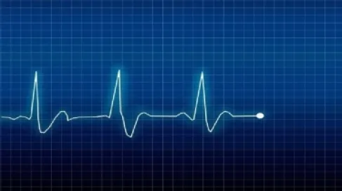 تسارع ضربات القلب بعد القهوة.. كيف تتعامل مع جرعة الكافيين الزائدة؟