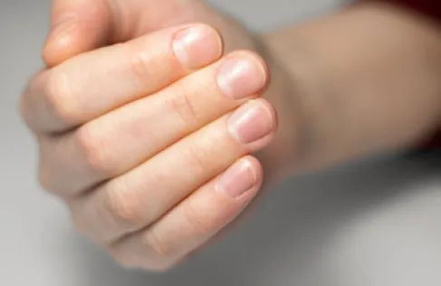 تغير بسيط في الظفر قد يكون علامة على مشكلات صحية كامنة