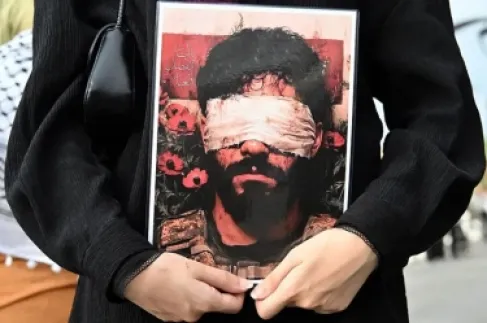 كيف غيّرت انفجارات (البيجر) تاريخ إصابات العيون في الحروب؟